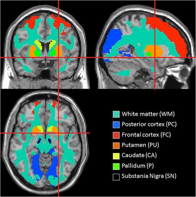 Blood–Brain Barrier Leakage Is Increased in Parkinson’s Disease